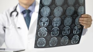 A doctor sitting on a desk looking at MRI scan of the brain of a patient.