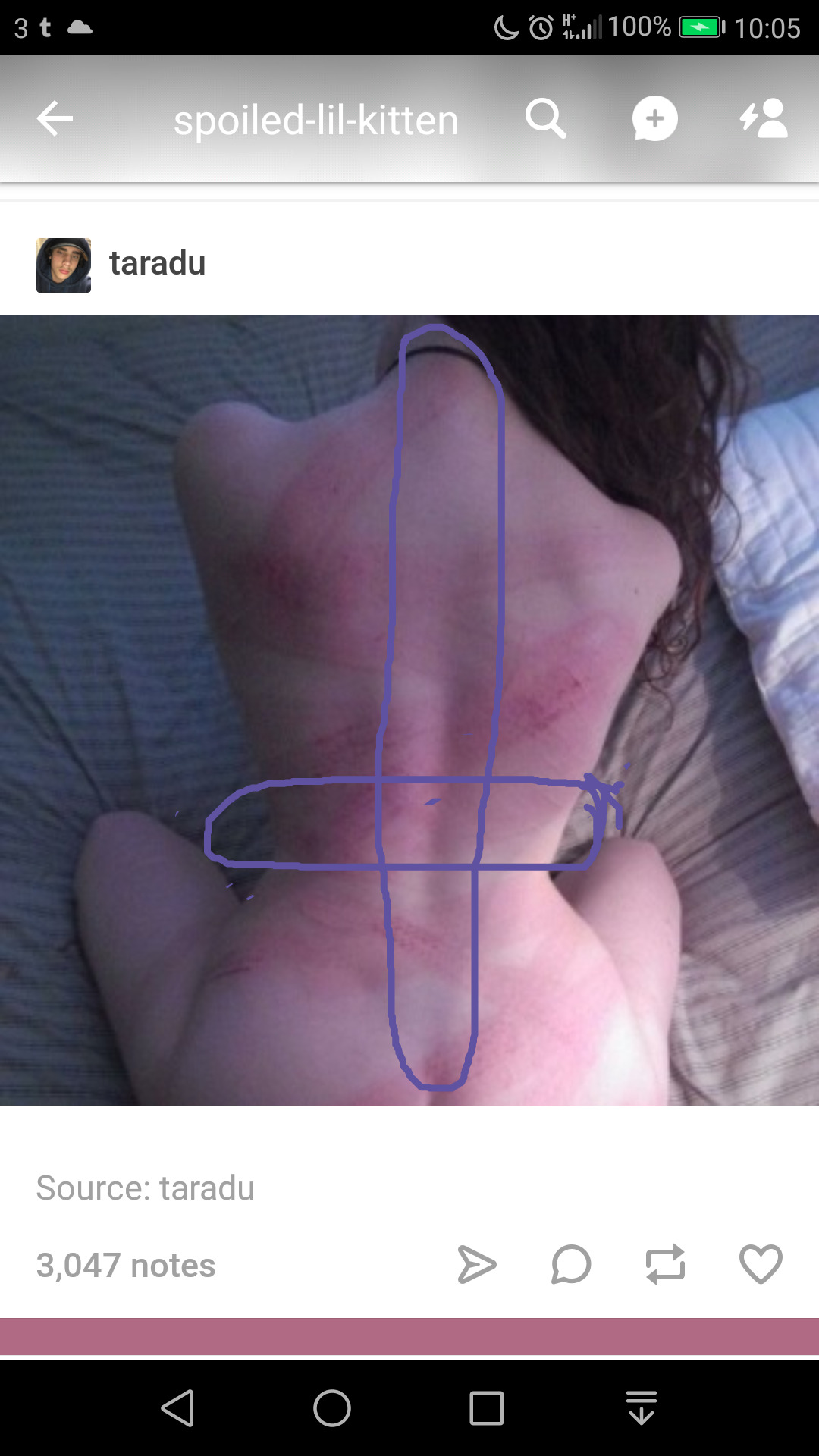 thejazzdaddy:
?daddydomdisaster:
?beautyinthekink:
?partlycontrolledbeast:
? playfully-sadistic:
? DO NOT INJURE THE SPINE OR KIDNEYS! Impact play should never ever take place in those areas!!
Educate yourself, folks! It?s a shame how many fake doms...