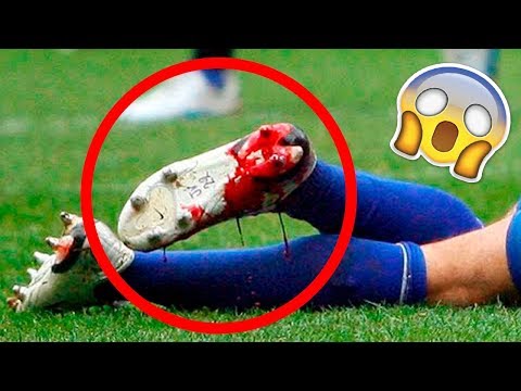 Las PEORES LESIONES del Mundo del FÚTBOL de los Ultimos Años