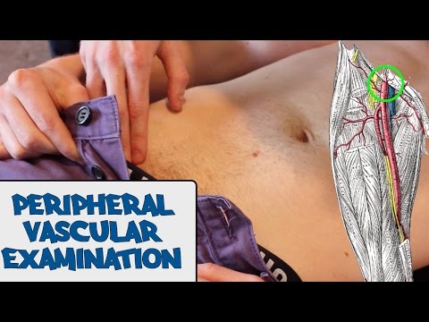 Peripheral Vascular Examination - OSCE Guide (New Version)