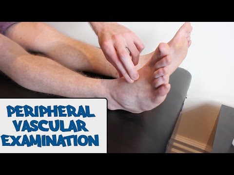 Peripheral Vascular Examination - OSCE Guide  (Old Version)