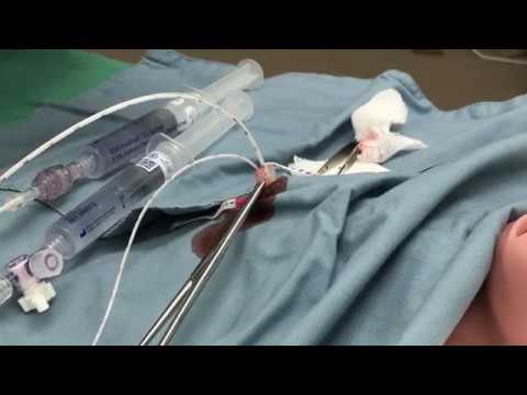 Video 3: Insertion of UVC and UAC