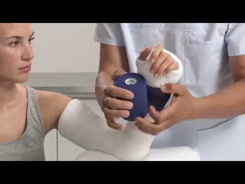 Plaster of Paris Elbow Splint Application