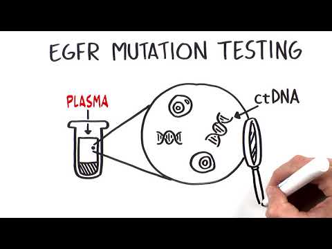 Clinical Utility of Liquid Biopsy for EGFR Mutation