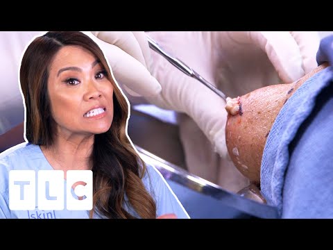 "It Does Look Like Oatmeal!" | Dr. Pimple Popper Pop Ups