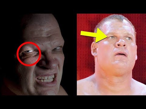 What Happened to Kane’s Eye? - 5 Things WWE NEVER Explained About Kane!