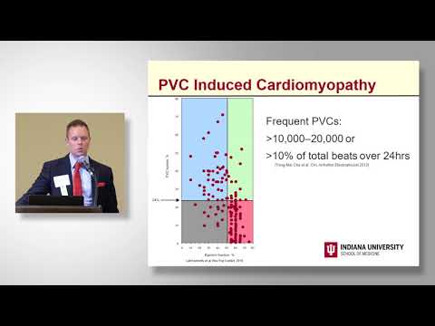 Michael Emery, MD, Premature Ventricular Contractions  When to be Concerned and Which Tests to Evalu