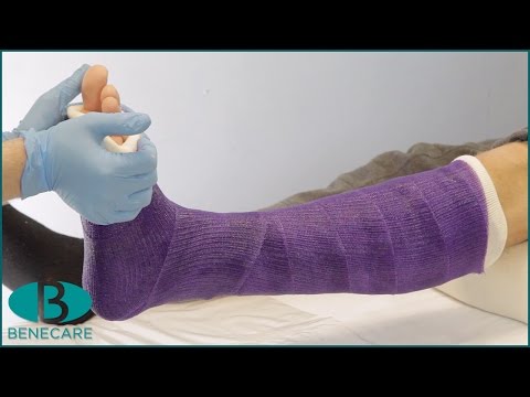 How to Apply a Below Knee Conventional Cast