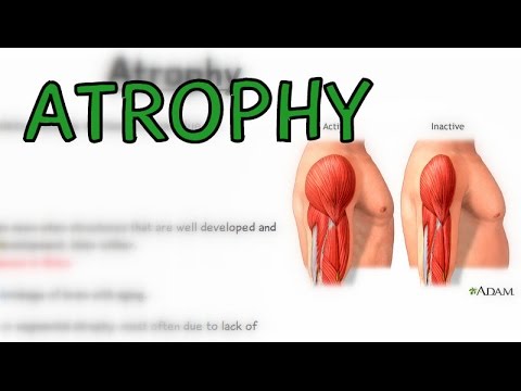 What is Atrophy? Types - Cachexia