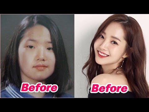 13 Korean Celebrities Who Undergo Plastic Surgery