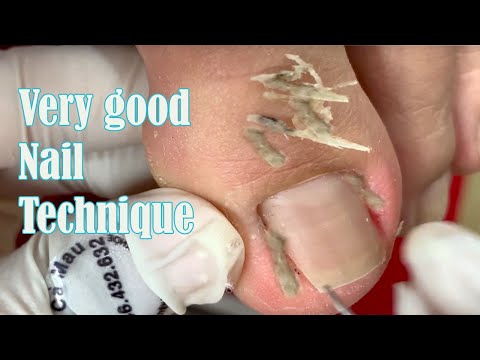 Very good Nail Technique