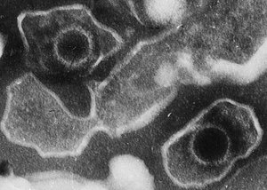 Electron micrograph of two Epstein–Barr virions (viral particles) showing round capsids loosely surrounded by the membrane envelope