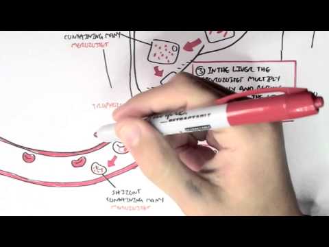 Malaria - Plasmodium