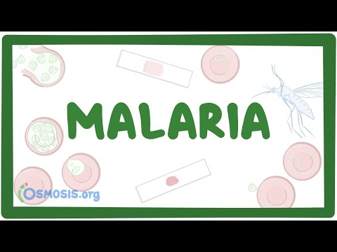 Malaria - causes, symptoms, diagnosis, treatment, pathology