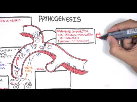 Malaria Pathophysiology