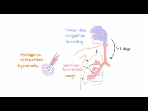 Respiratory Syncytial Virus (RSV) - Clinical Presentation