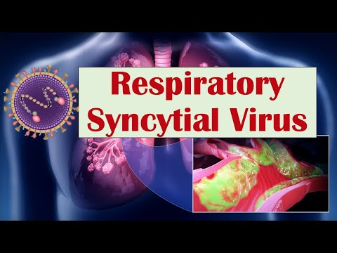 Respiratory Syncytial Virus (RSV) | What Is It & What Conditions Does it Cause (ex. Croup)