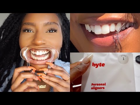 Fixing my TEETH!! Affordable Aligners to Straighten Teeth| My Byte Journey | iamLindaElaine