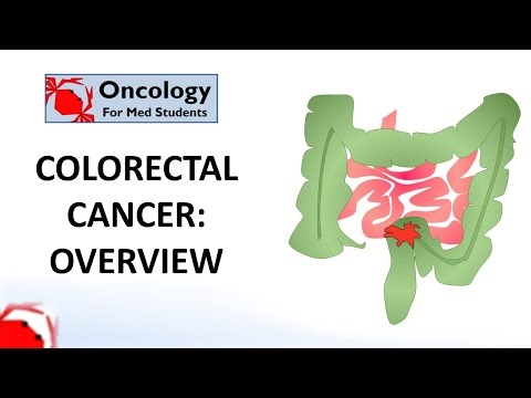 Colorectal Cancer: An overview