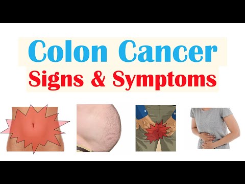 Colon Cancer (CRC) Signs & Symptoms (& Why They Occur)