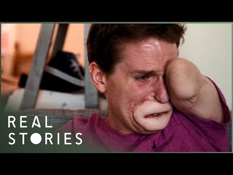 The Extraordinary Case of Alex Lewis | Real Stories