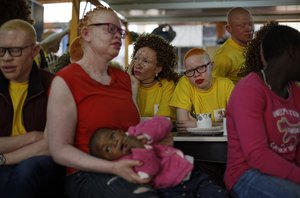 Contestants attend a rehearsal for the "Mr. & Miss Albinism East Africa" competition, organized by the Albinism Society of Kenya, in Nairobi, Kenya