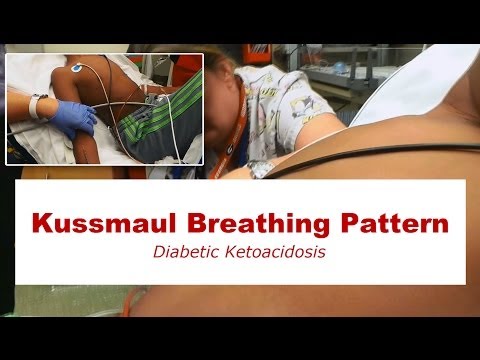 Kussmaul Breathing Pattern