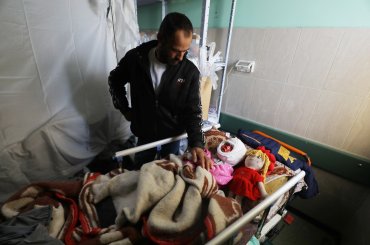 An severely burned Palestinian girl lies in a hospital bed with a cast a round her face, next to her toy doll. (APA Images)