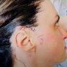 A woman interviewed by 60 Minutes (US), who says she was attacked by an energy weapon while stationed in Tbilisi, Georgia. She later had metal plates implanted in her head after her ears were permanently damaged.