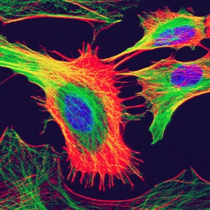 Astrocytes from the brain of a mouse are stained in neon colors that emphasize their stretched, starlike shape.