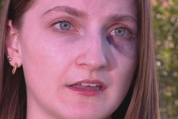 Breanna Coats was attacked while jogging.