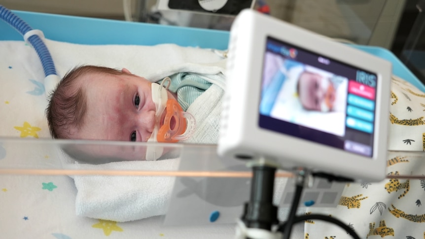 A baby with a breathing tube displayed on a screen attached to a cot