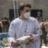 Dr Ihor Kolodka, covered in his own blood, helps others clear rubble after a Russian missile strike on the Ohmatdyt children’s hospital.