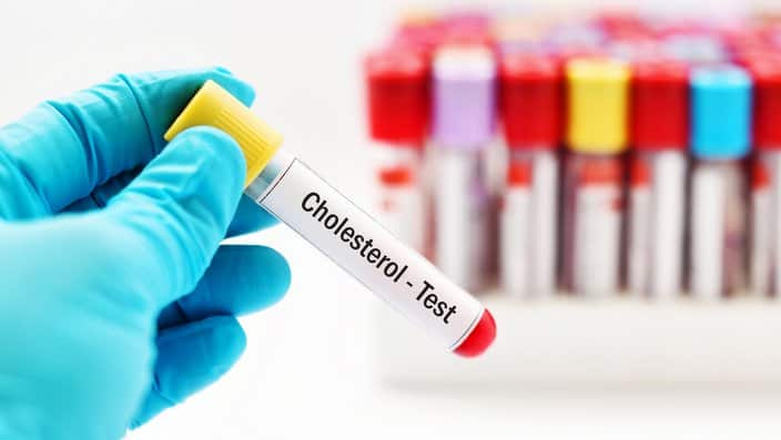 Cholesterol test