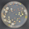 A colony of bacteria and fungi caught in air samples during research flights.