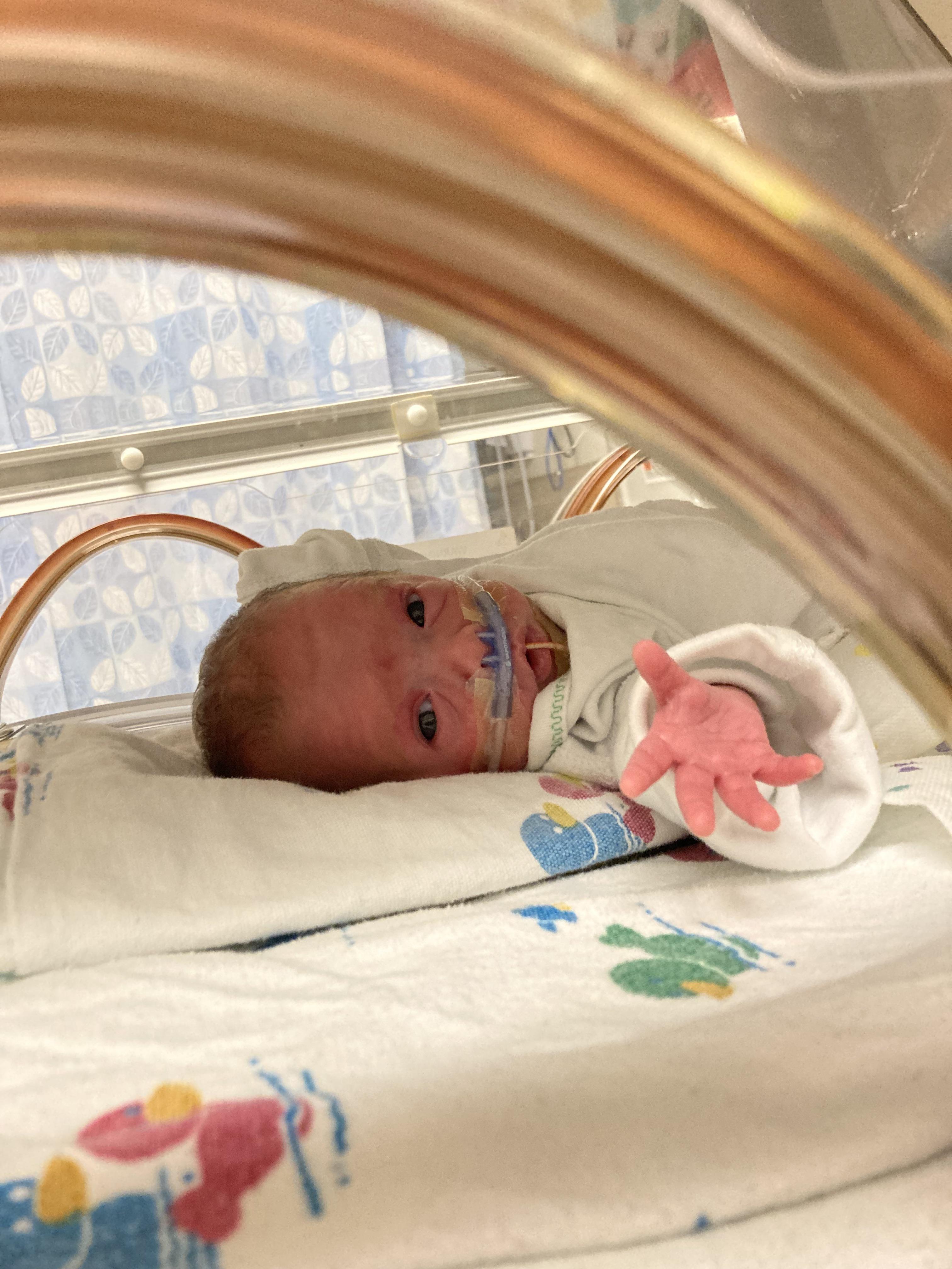 r/pics - My micro-premie daughter reaching out to me from the NICU. It’s tough man…