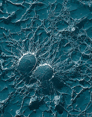 Staphylococcus aureus, 50,000x, USDA, ARS, EMU.jpg