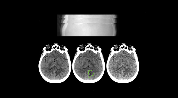 CT imaging of a human brain