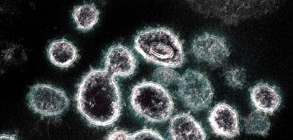 Coronavirus Image