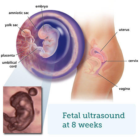 ultrasound scan