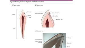 Small Study Finds Clues To Mom’s Adversity In Baby Teeth