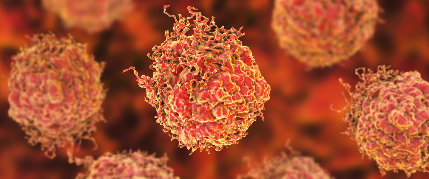 3D illustration of prostate cancer cells