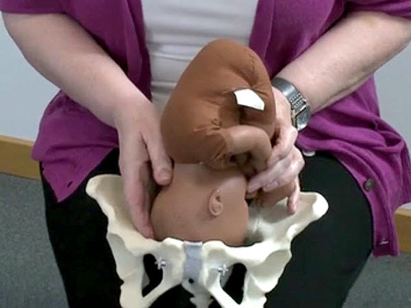 Toy doll  folded in a head-down birthing position and placed in an artificial pelvis