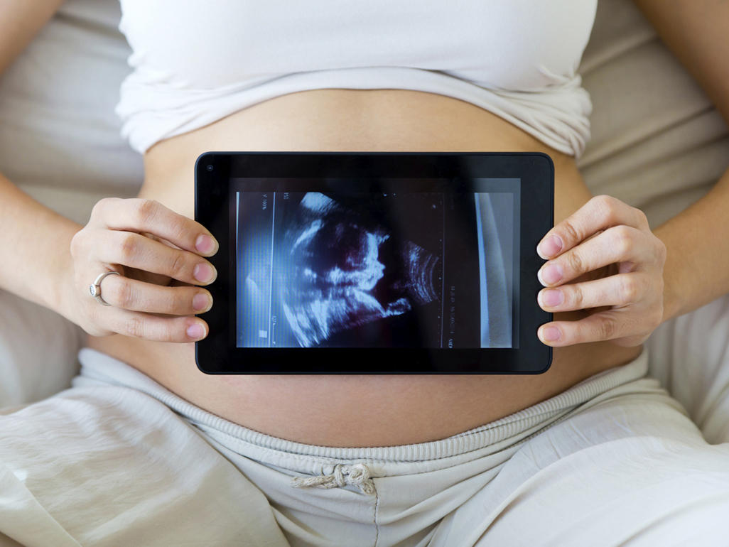 pregnant woman holding her first-trimester ultrasound image on a tablet in front of her belly