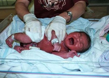 Newborn baby operating room