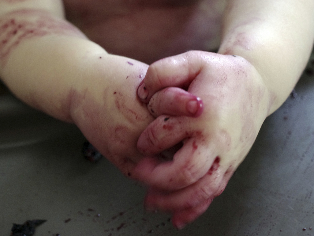 child's hands drenched in purple liquid