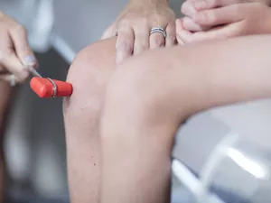 doctor testing child's knee reflexes with rubber hammer