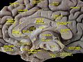 Cerebrum. Medial face. Deep dissection.