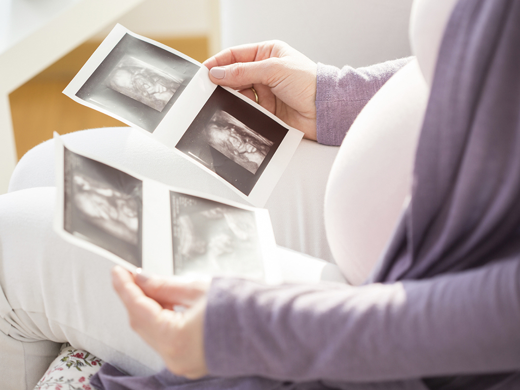 pregnant woman looking at the ultra-sound images of an unborn baby