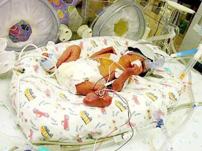 Premature baby in an incubator